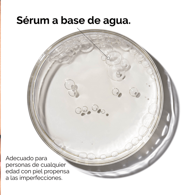Aloe 2% + Nag 2% - Solución post acné, para pieles propensas a imperfecciones