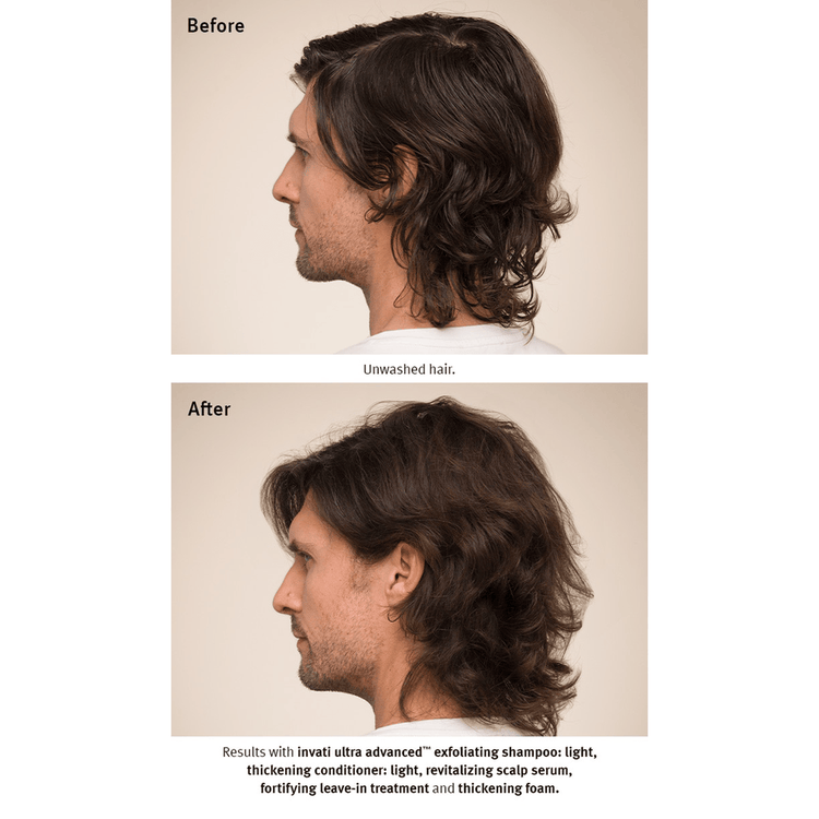 Invati Ultra Espuma evita la caida del cabello y engrosa la fibra capilar