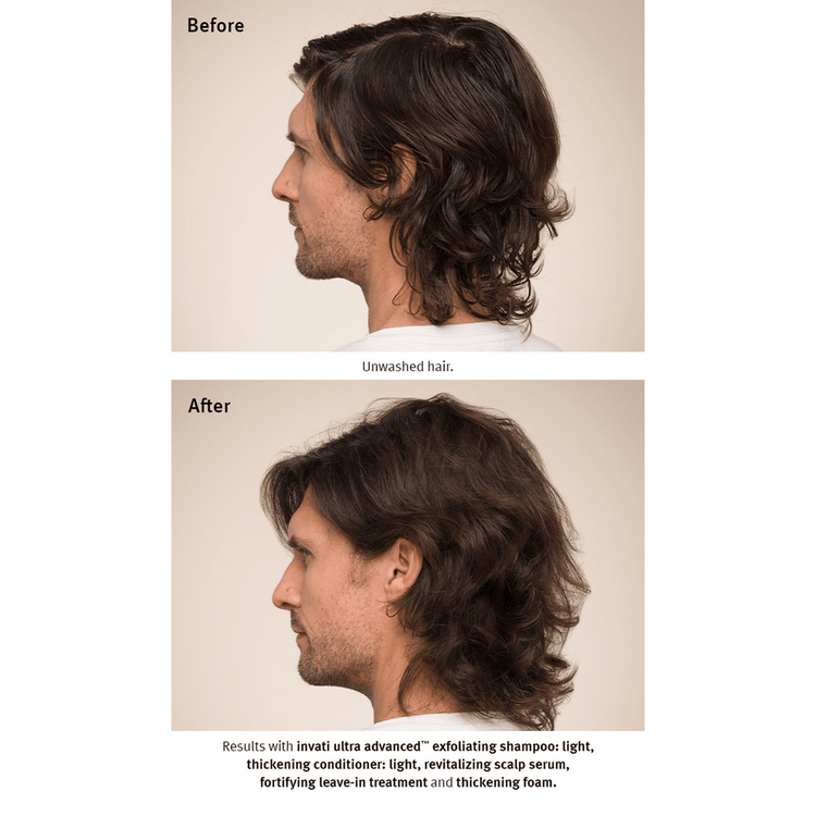 Invati Ultra Suero evita la caida del cabello y engrosa la fibra capilar