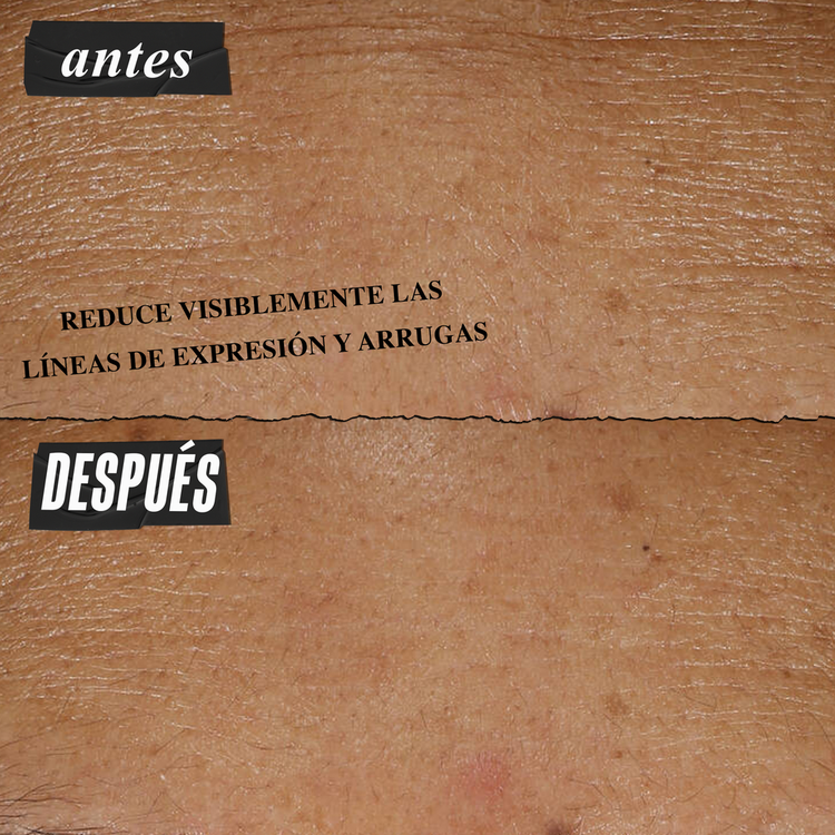 Micro-Dose - Suero antiedad, mejora la tolerancia de la piel al retinol puro