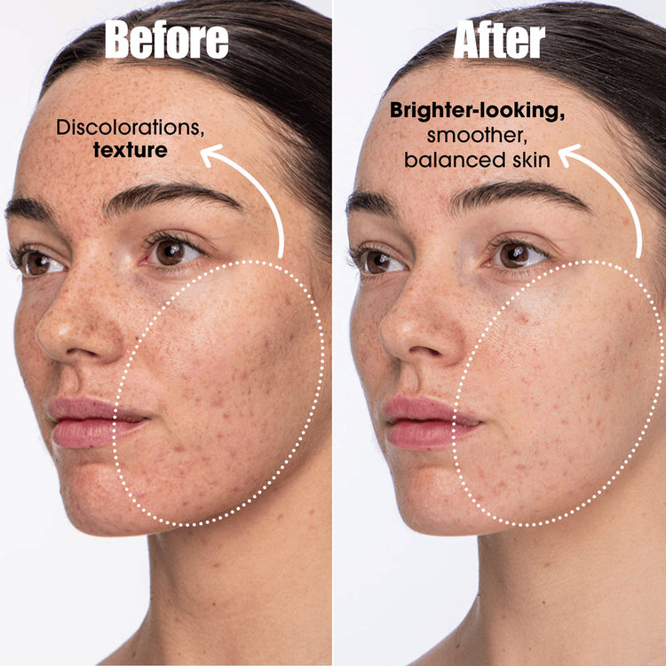 Detox Darling Tónico reduce el exceso de grasa