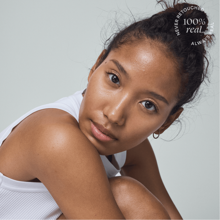 ACNE HEROES Rutina para acné previene y trata el acné