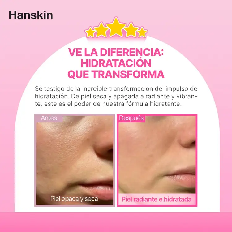 Hyaluron Skin - Esencia, brillo radiante