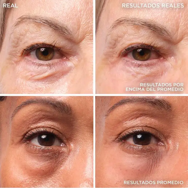 Bye Bye Under Eye Bags Tratamiento ojos atenua manchas de acné, apto para piel sensible