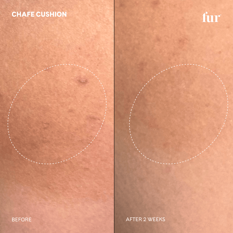 Chafe Bálsamo calmante y ligera