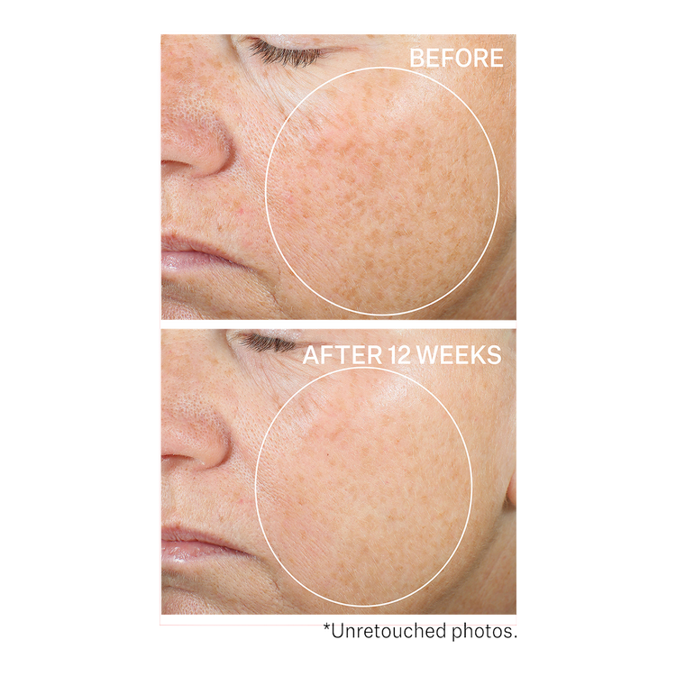 Super-C Retinol Brighten & Correct Vitamin C Suero iluminador ilumina la piel