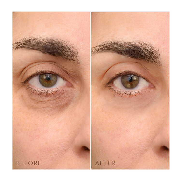 Iris Crema iluminadora para contorno de ojos