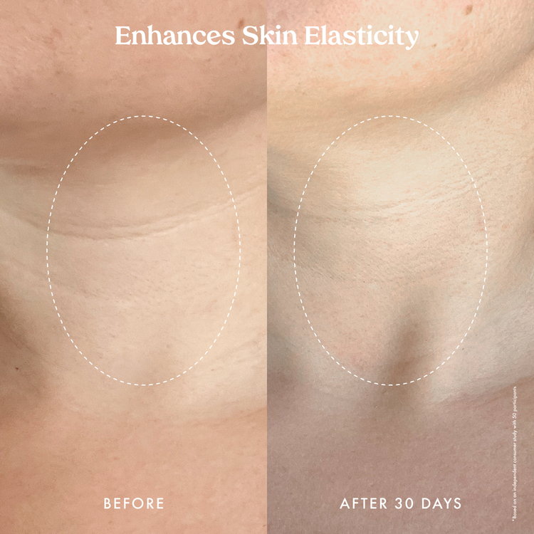 Ultra Restore - Suero corporal reafirmante, reafirma e hidrata la piel