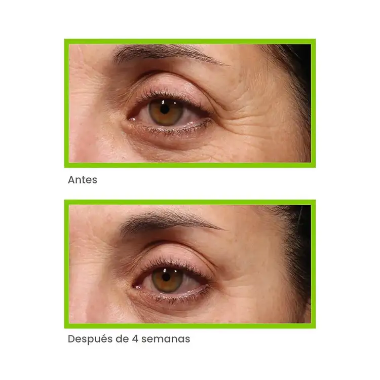 Antiedad - Retinol Youth Renewal Eye Serum Suero antiedad minimiza líneas de expresión