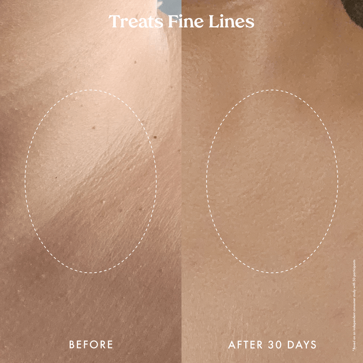 Ultra Renewal Retinol Crema corporal renovadora renueva e hidrata la piel