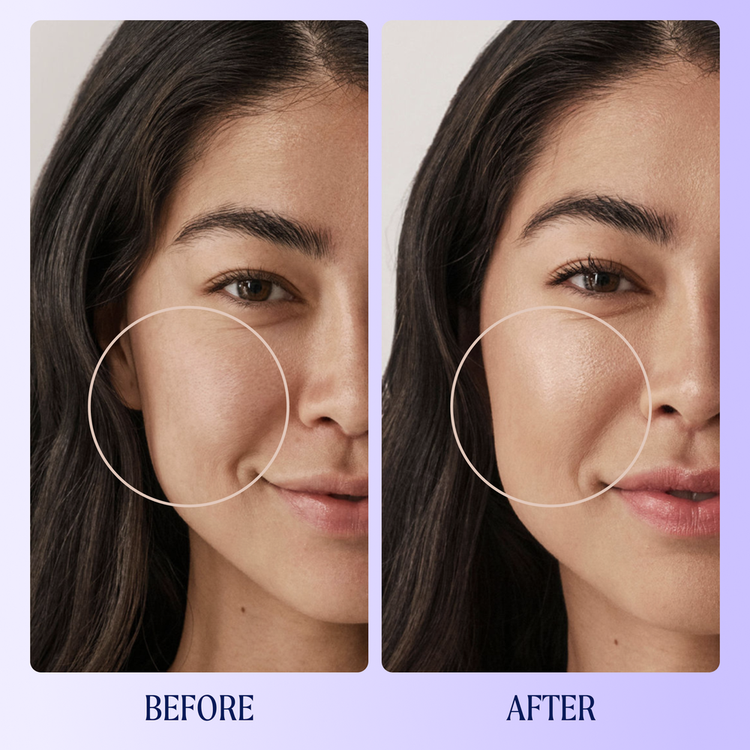 Self Reflect Protector solar protección solar