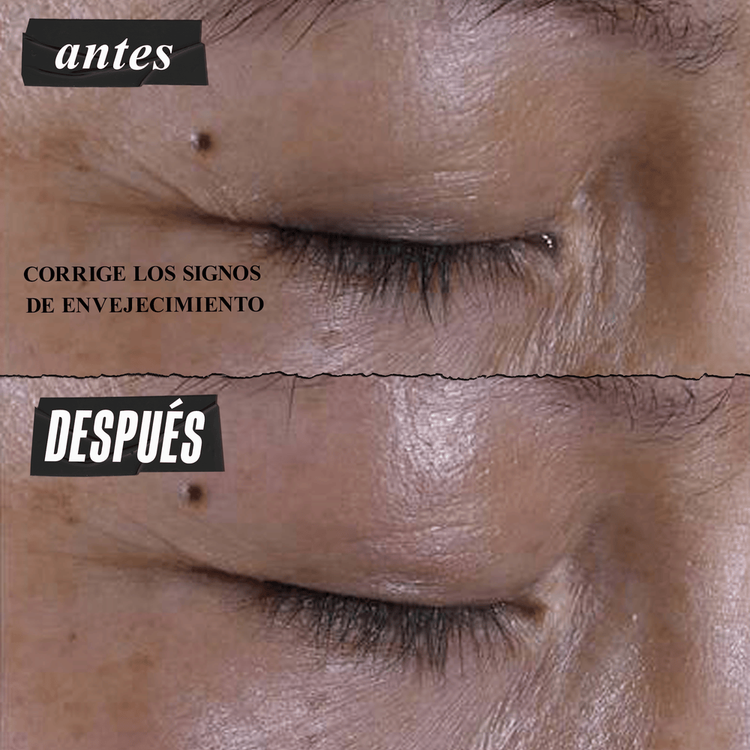 Super Multi-Corrective - Contorno de ojos antiedad, de rápida absorción