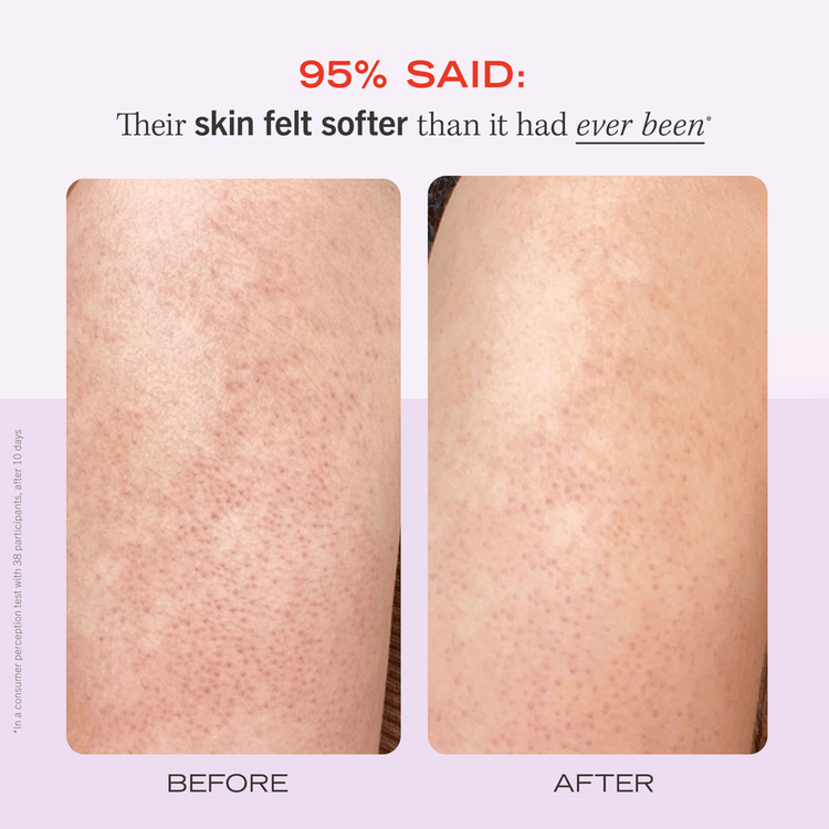 KP Bump Eraser Body Scrub Fresh Strawberry Exfoliante corporal, tamaño para viaje