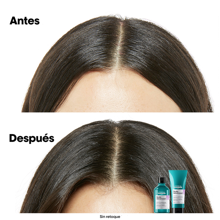 Scalp Advance - Shampoo, elimina caspa y protege cuero cabelludo