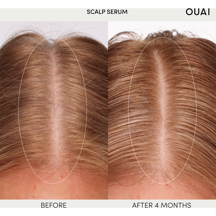 Scalp - Suero, hidrata el cuero cabelludo