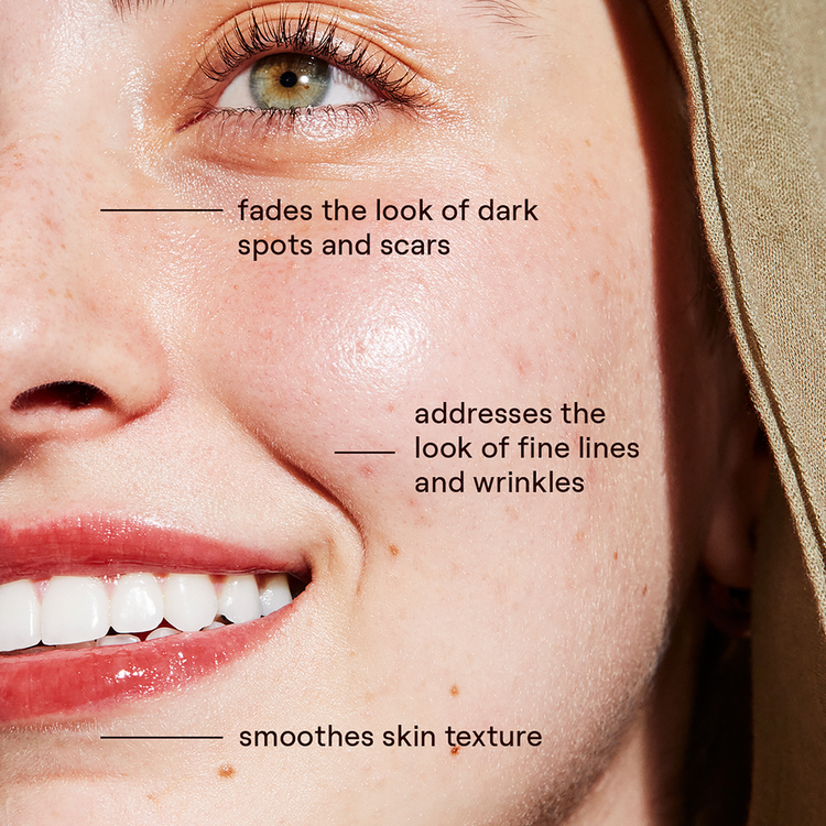 Superhue Hyperpigmentation Suero en barra reduce apariencia de manchas