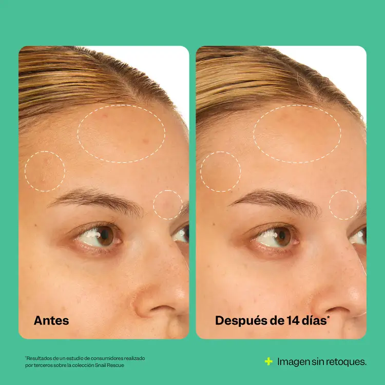 Snail Rescue - Suero facial, hidrata la piel