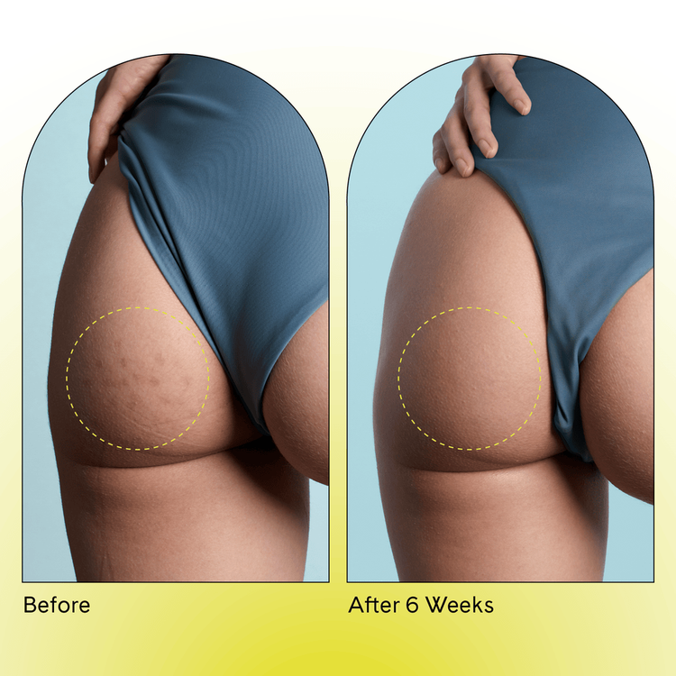 Dark Spot Parche trata manchas oscuras