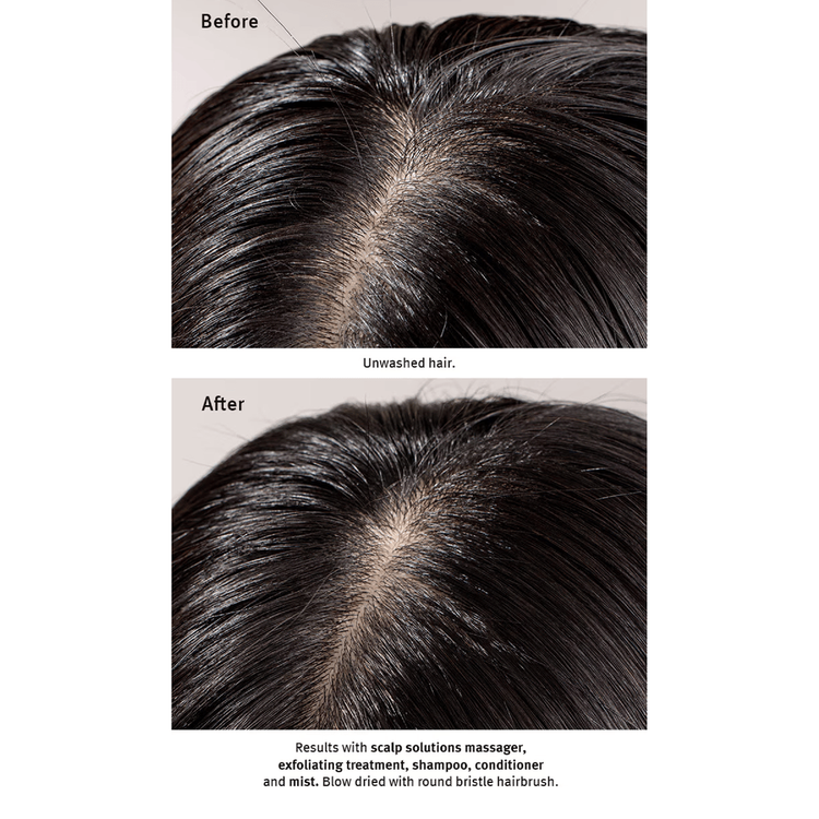 Scalp Advanced - Exfoliante para cuero cabelludo, hidrata y cuida el cuero cabelludo