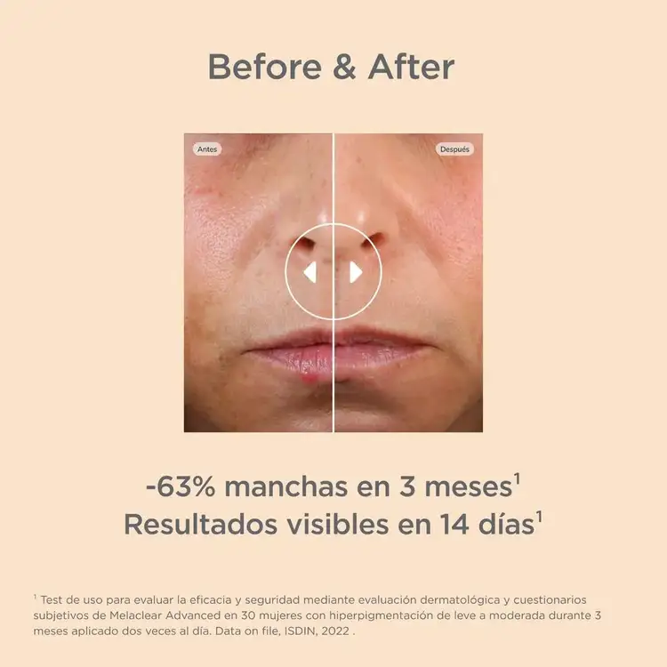 Isdinceutics Suero despigmentante reduce manchas faciales