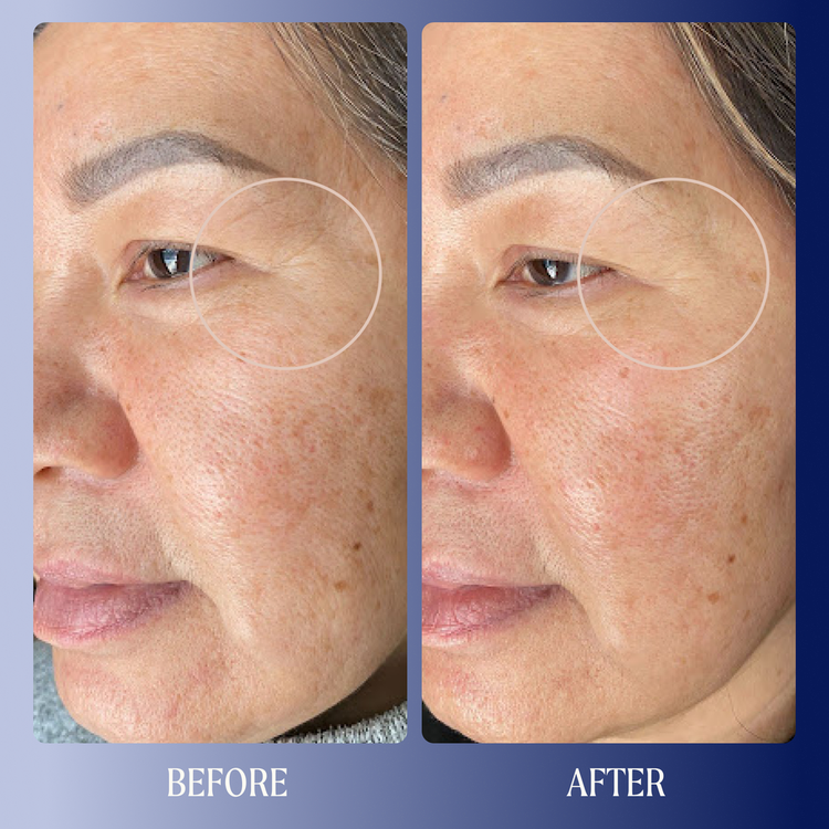 Dreamwave 2% Bio-Retinoid Complex Suero de renovación nocturna ideal para pieles sensibles