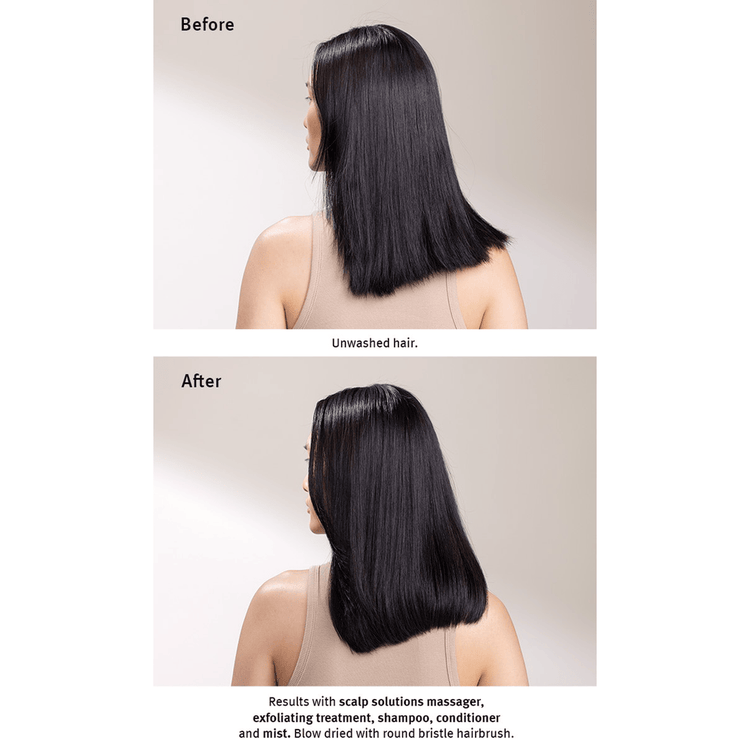 Scalp Advanced Mist protector para cabello hidrata y cuida el cuero cabelludo