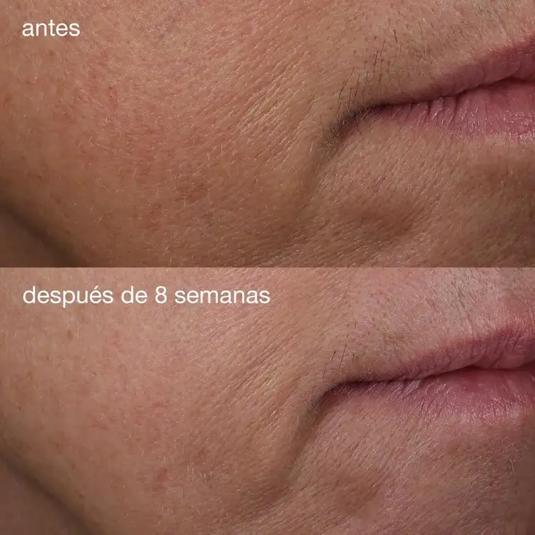 Phyto Nature Firming Serum Suero reafirma, levanta y rejuvenece la piel.