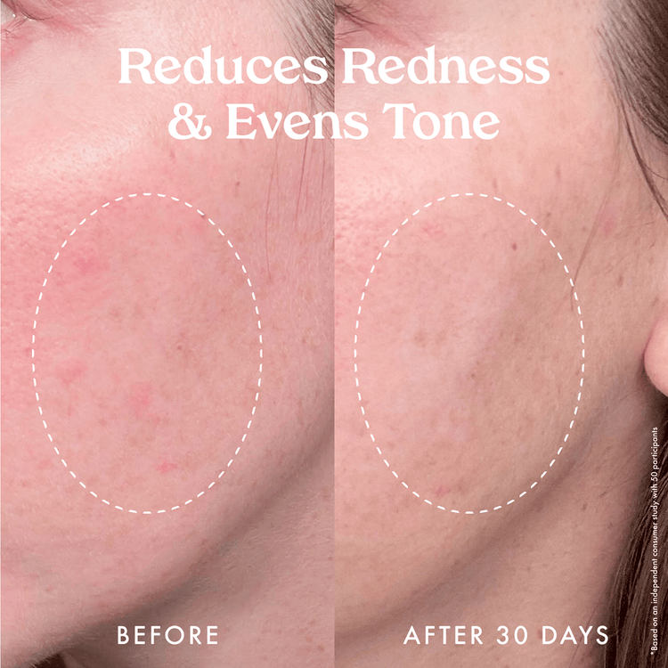 Star Bright Vitamin C - Suero antimanchas, hidrata la piel