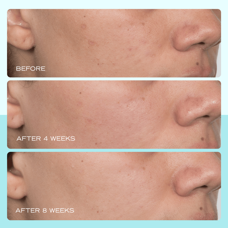 Facial Radiance Niacinamide Dark Spot Serum Suero facial antimanchas reduce manchas