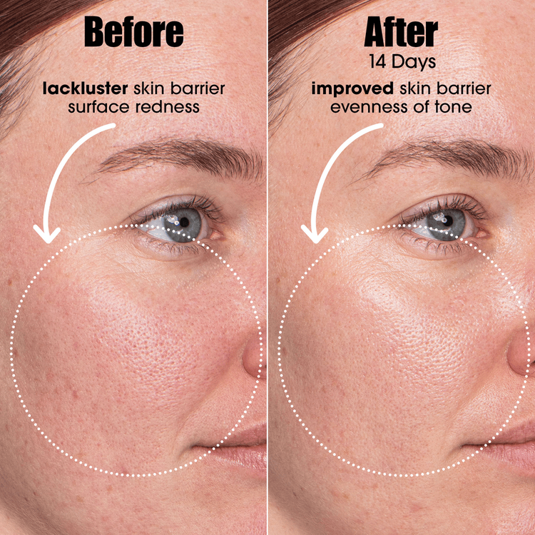 Ai Smart Retinol Suero tratamiento de alto rendimiento