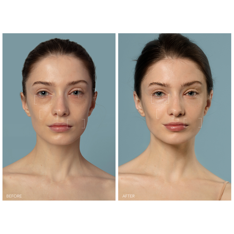 Ufo 3 Dispositivo de hidratación facial 5 en 1