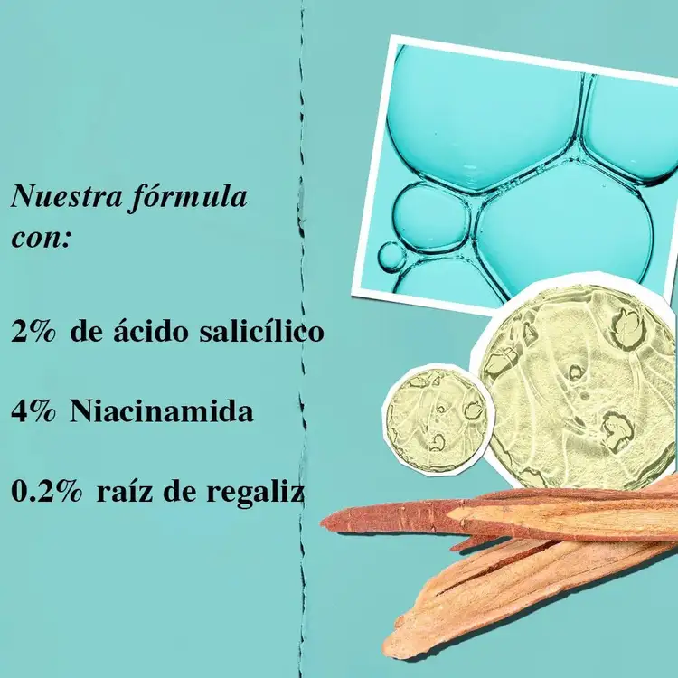 Acne Suero elimina imperfecciones por acné y descaneve marcas