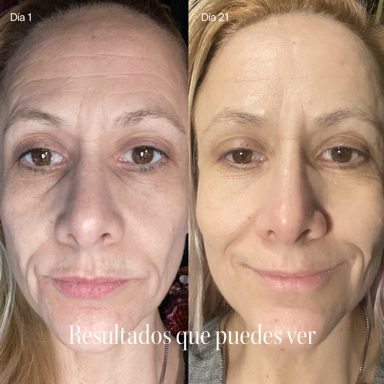 Wrinkle Retreat - Mascarilla Facial de Fototerapia LED, antienvejecimiento - Therapy Mask