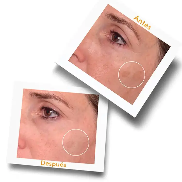 Rapid Dark Spot Correcting Serum Tratamiento para manchas oscuras para manchas oscuras