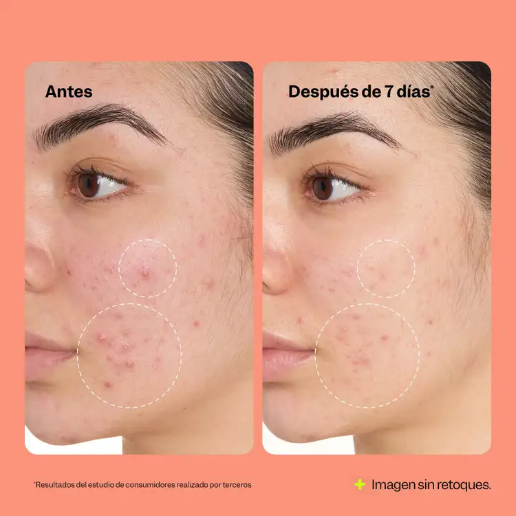 Fix All Recovery - Spray, purifica y calma la piel