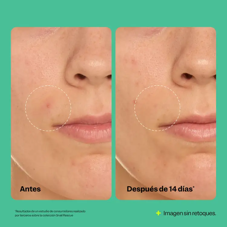 Snail Rescue - Limpiador purificante, limpieza profunda