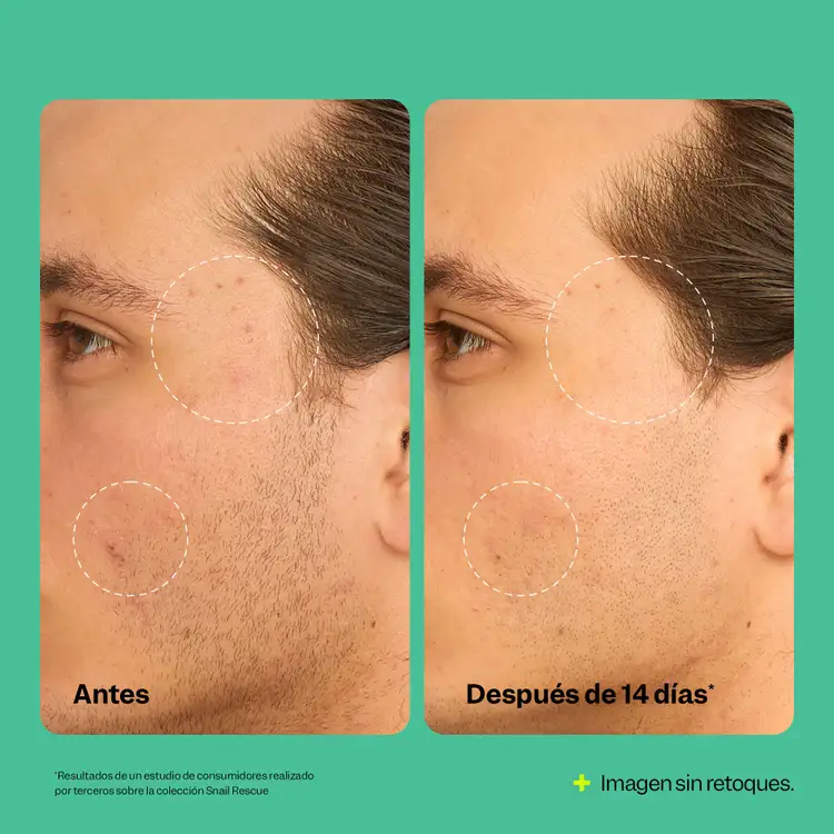 Snail Rescue - Tónico facial, hidrata la piel