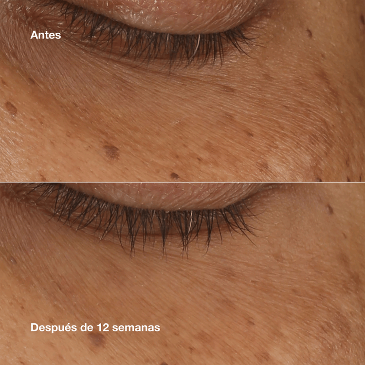 All About Eyes Serum Concentrate Crema para contorno de ojos hidrata y suaviza la piel