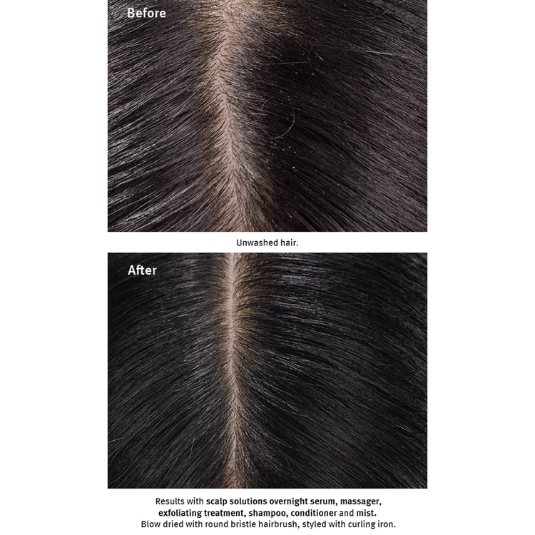 Scalp Advanced - Exfoliante para cuero cabelludo, hidrata y cuida el cuero cabelludo
