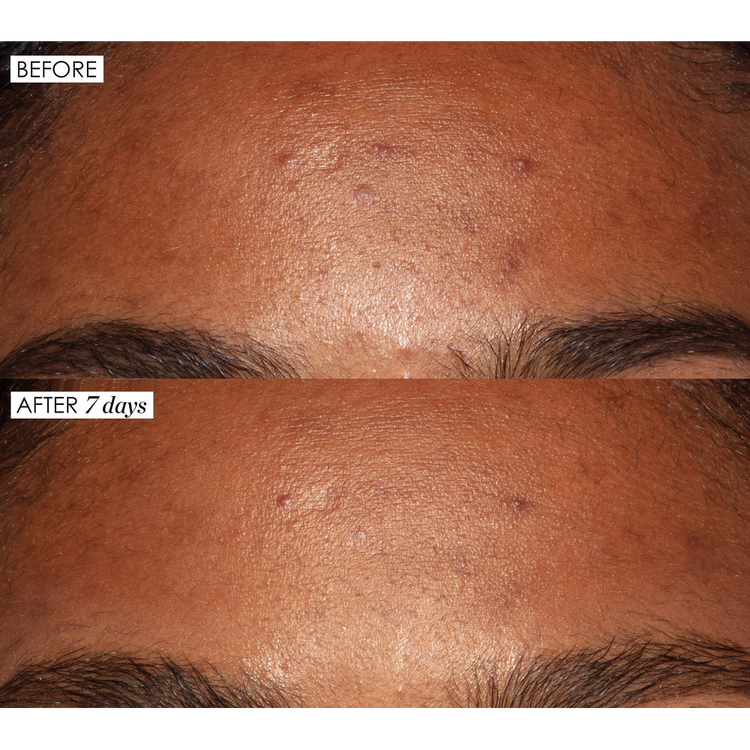 Good Genes All-In-One - Suero multitratamiento, exfolia y rellena la piel