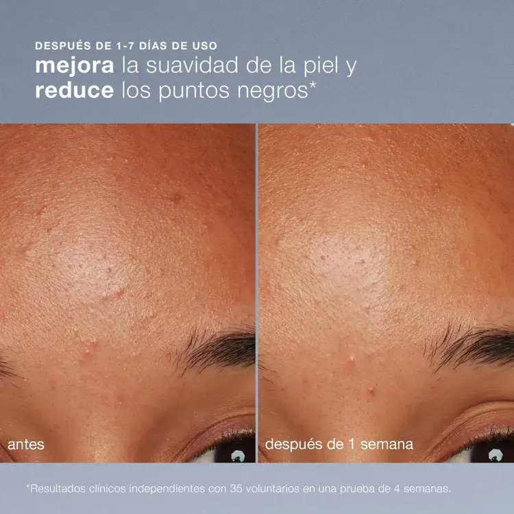 Daily Microfoliant Exfoliator Exfoliante disminuye las imperfecciones
