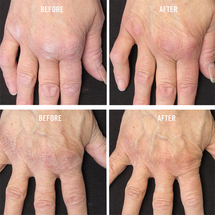 Travel Size Ultra Repair Cream Intense Hydration Crema hidratante intensiva hidratación profunda e inmediata