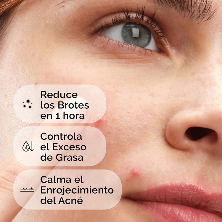 Sulfur 10% Powder-To-Cream - Concentrado de azufre, para tratar brotes y reducir imperfecciones