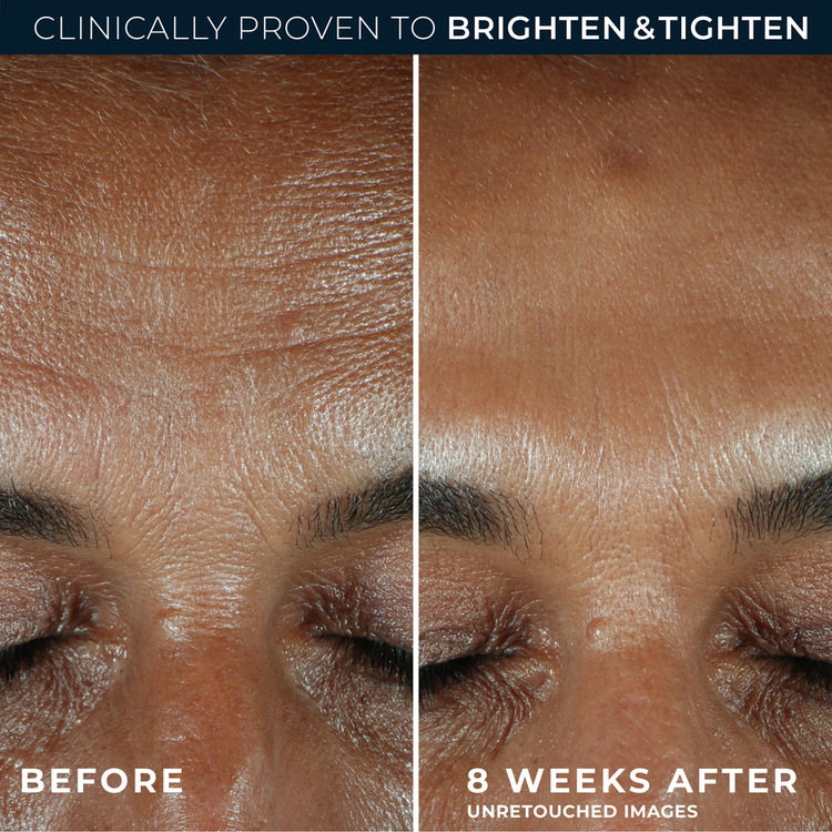 Multi Correxion - Suero facial, con Vitamina C para mejorar la luminosidad de la piel