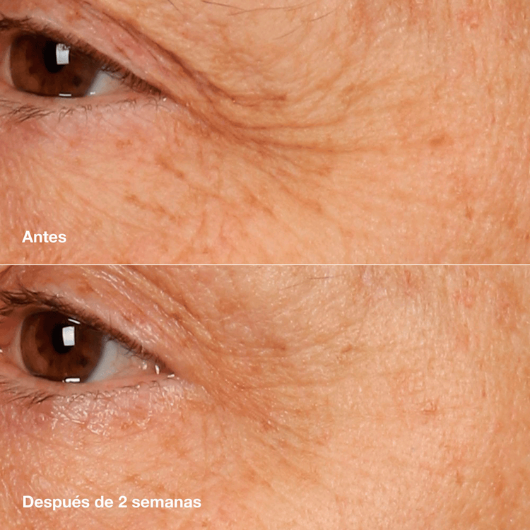 Smart Clinical Repair Retinoid - Bálsamo anti-envejecimiento, suaviza y rellena líneas finas