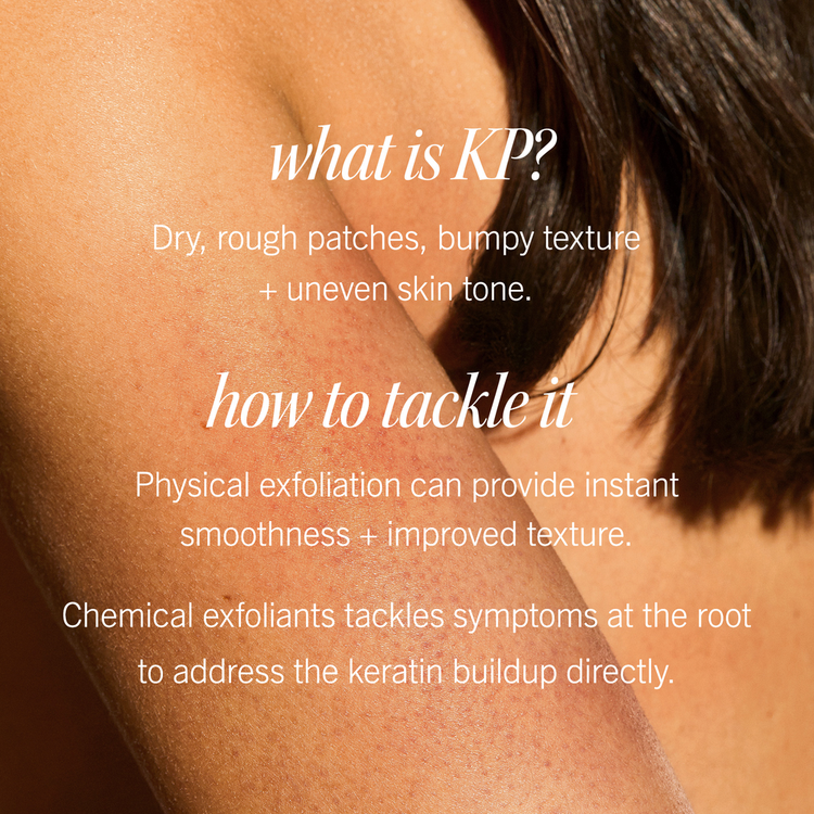 KP Bump Eraser - Exfoliante corporal con 10% de AHA, reduce la apariencia de los granitos