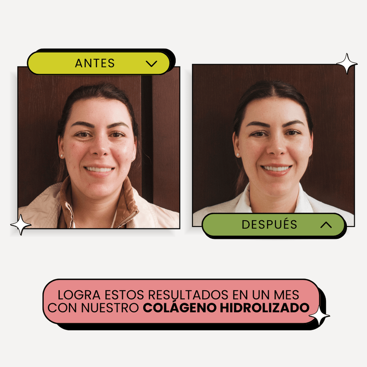 Suplemento alimenticio, para piel firme, cabello fuerte y articulaciones saludables