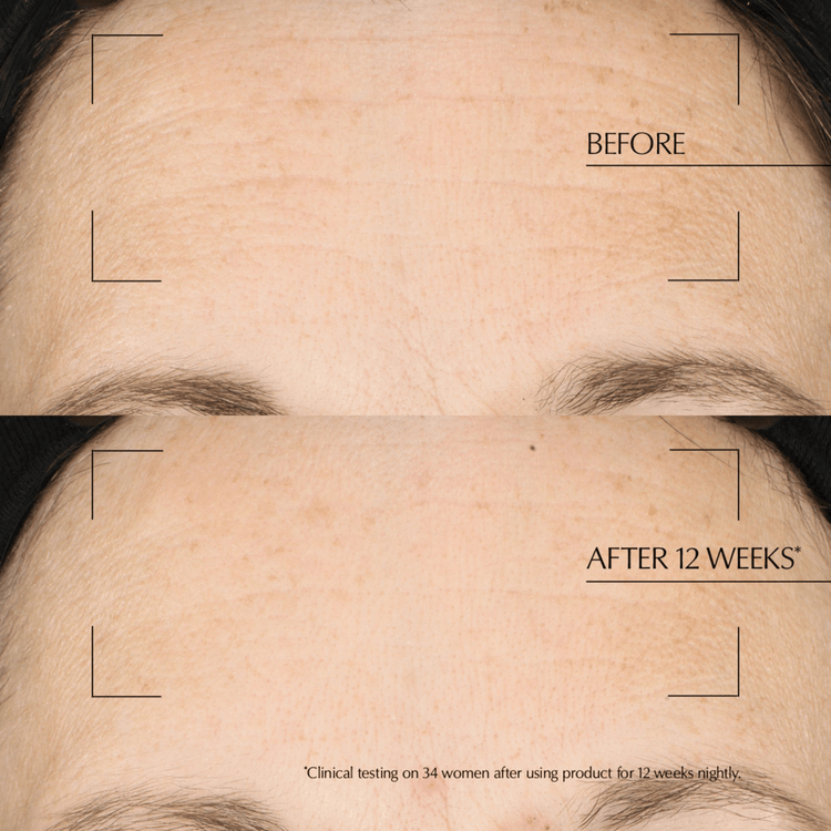 Advanced Night Repair Overnight Treatment Tratamiento nocturno reparador