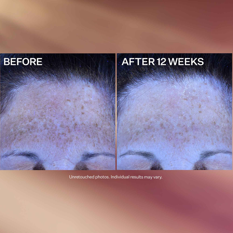 Super-C Night Vitamin C Crema de noche ilumina la piel