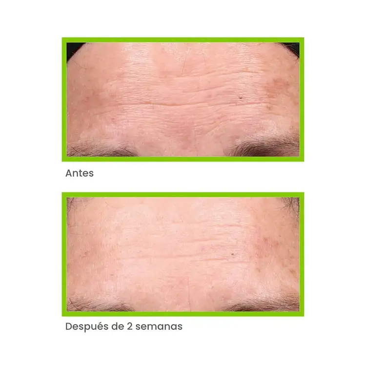 Antiedad - Retinol Youth Renewal Serum Suero antiedad previene y minimiza arrugas